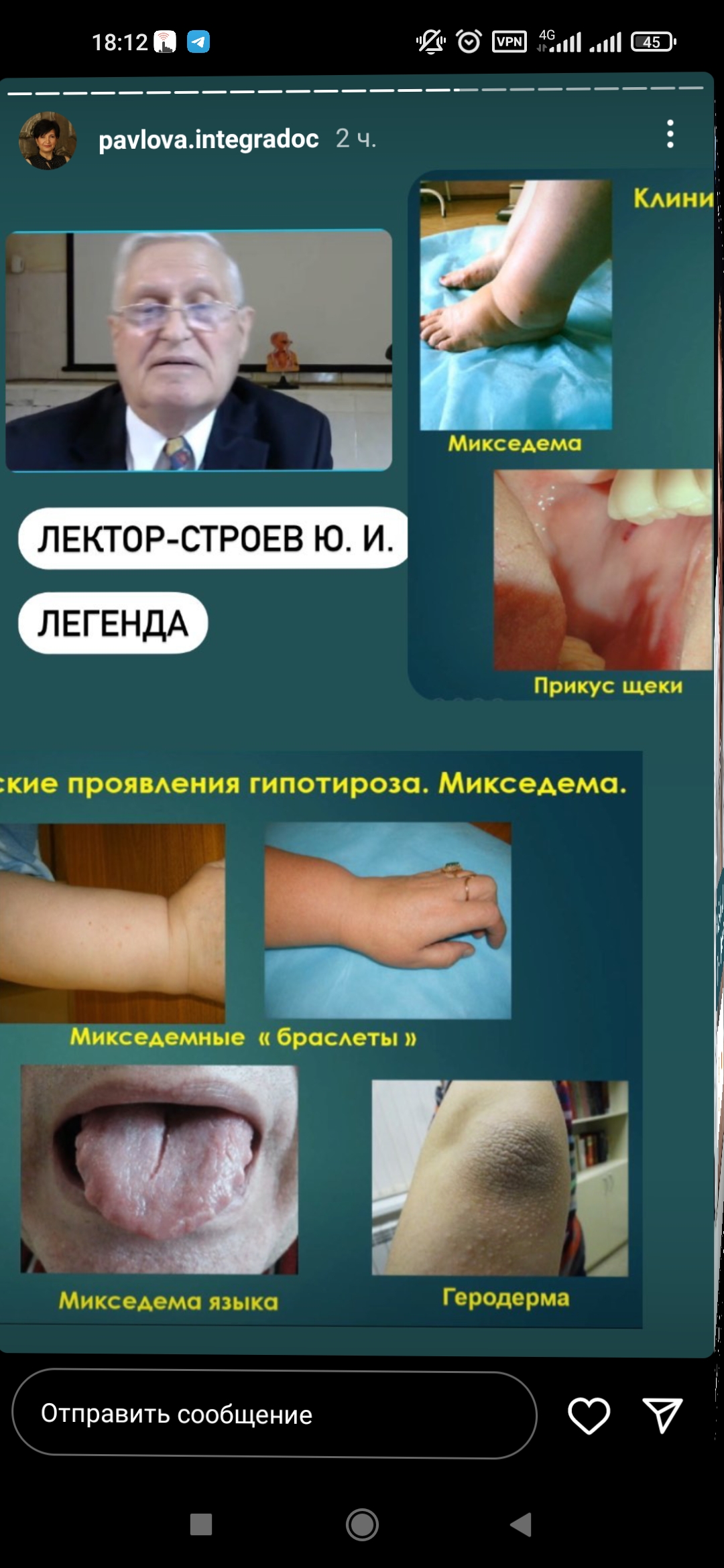/pic/uploaded/eScreenshot_2022-04-06-18-12-23-001_com.instagram.android.jpg